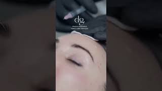 Understanding Subtle Facial Volume Restoration