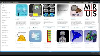 04 3dSlicer Extensions Example HD Brain Segmentation