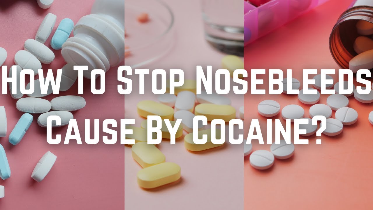How To Stop Nosebleeds Cause By Cocaine?
