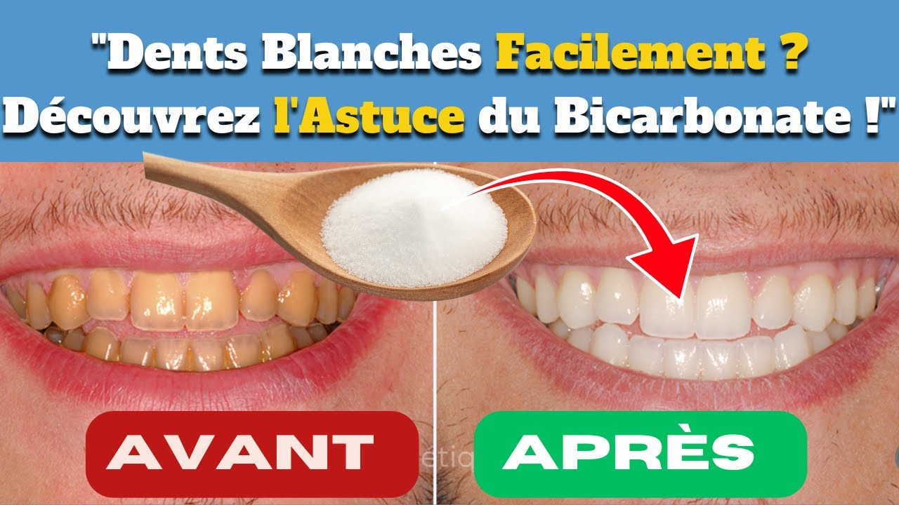Pourquoi les dentistes recommandent-ils le bicarbonate de soude pour
