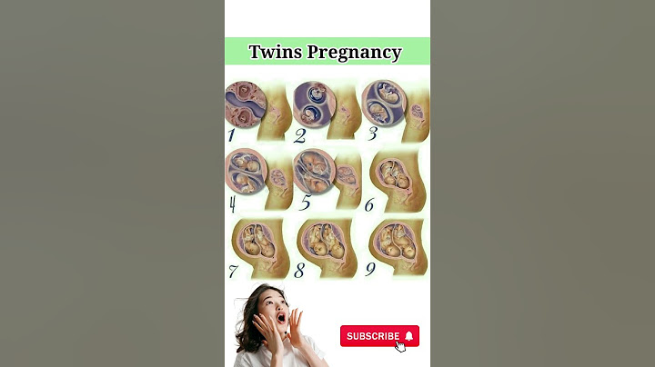 Twins Pregnancy #twins #pregnancy #pregnancyjourney #pregnancyweekbyweek
