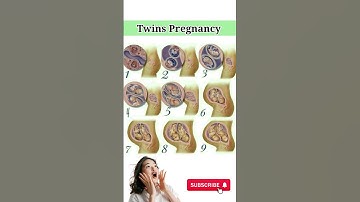 Twins Pregnancy #twins #pregnancy #pregnancyjourney #pregnancyweekbyweek