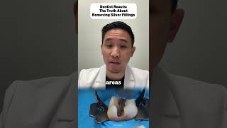 Should You Remove Silver Fillings Mercury Risks! #dentistry #amalgam #oralhealth