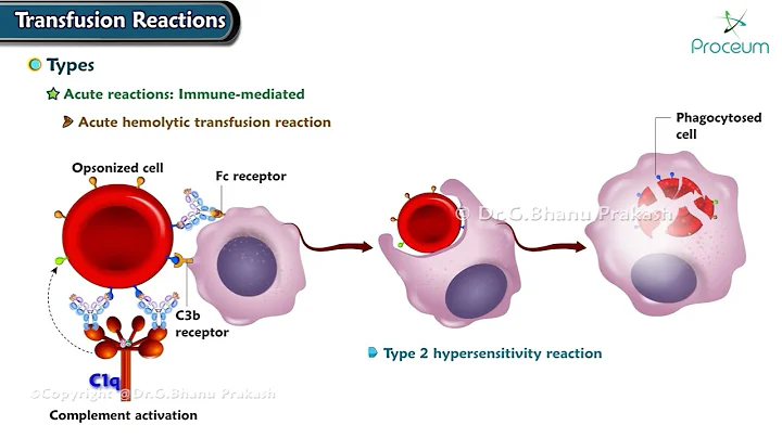 Transfusion Reactions : Hematology