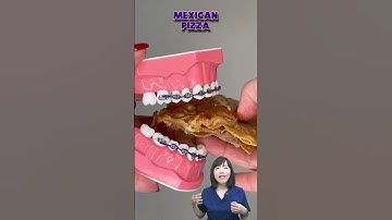 Đồ ăn nào an toàn cho răng niềng | Dr Anh Thư