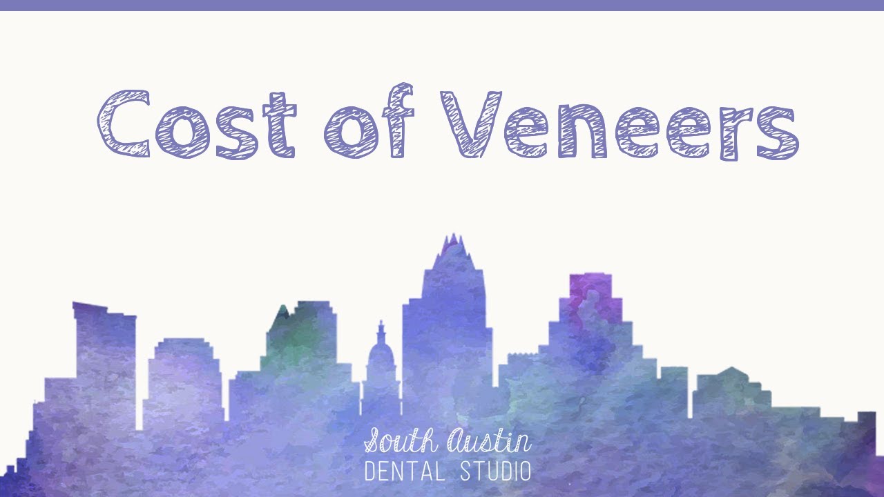 Cost of Veneers YouTube