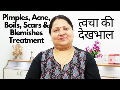 Single Point Treatment for Facial Skin (Pimples, Acne, Boils, Scars & Blemishes)(त्udवचा की देखभाल!!)