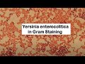 Gram Negative Rods of Yersinia enterocolitica
