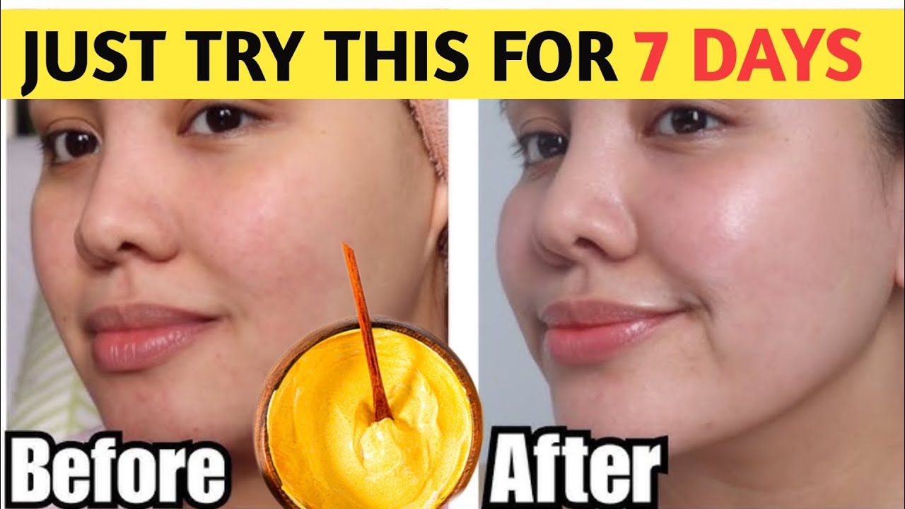 Naturally Glowing Skin within 7 days || Natural Home Remedy | Dr. Radha ...