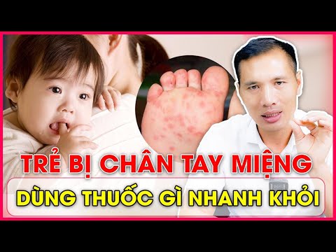 Lưu ý khi