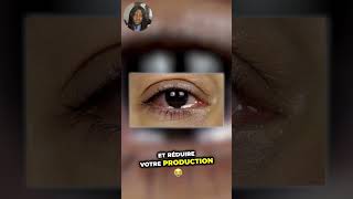 Maladie Des Yeux : Top Des Affections Causant La Sécheresse Oculaire