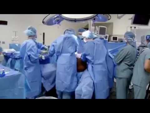 Vídeo: Tumor De 132 Libras Removido Da Mulher