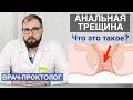 Что такое анальная трещина