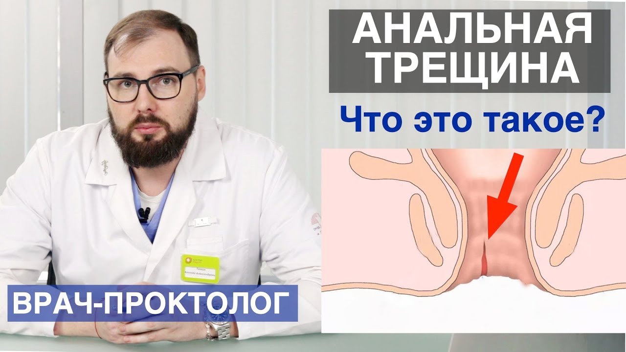Есть Ли Вред От Анального Секса