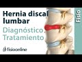 Hernia discal lumbar - Diagnóstico, consejos, ejercicios y tratamiento de fisioterapia