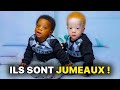 Des jumeaux noirs naissent de couleurs diffrentes cest choquant ce qui leur est arriv 