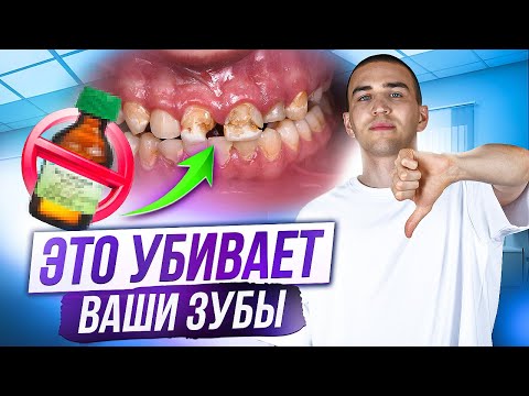 Вы чистите зубы НЕ ПРАВИЛЬНО! Топ 5 ошибок гигиены полости рта