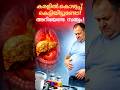 “ഫാറ്റി ലിവർ ഉണ്ടോ? പേടിക്കേണ്ട! 60 സെക്കൻഡിൽ ശരിയായ വഴി അറിയൂ | Fatty Liver Early Action