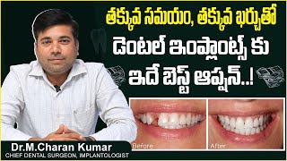 అతి తక్కువ సమయంలో ఇంప్లాంట్స్| Dental Implant Surgery Procedure in Telugu | Eledent Dental Hospitals
