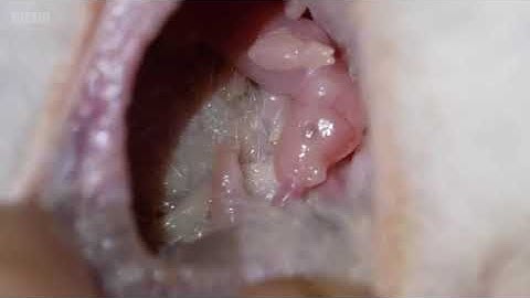 (pregnant bilby showing live babies in womb) The bilbies ‘thriving’ after 100-year absence Australia