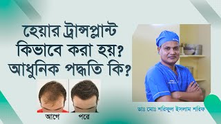 হেয়ার ট্রান্সপ্লান্ট কি? কিভাবে করা হয়? Hair Transplants and Treatment 2022