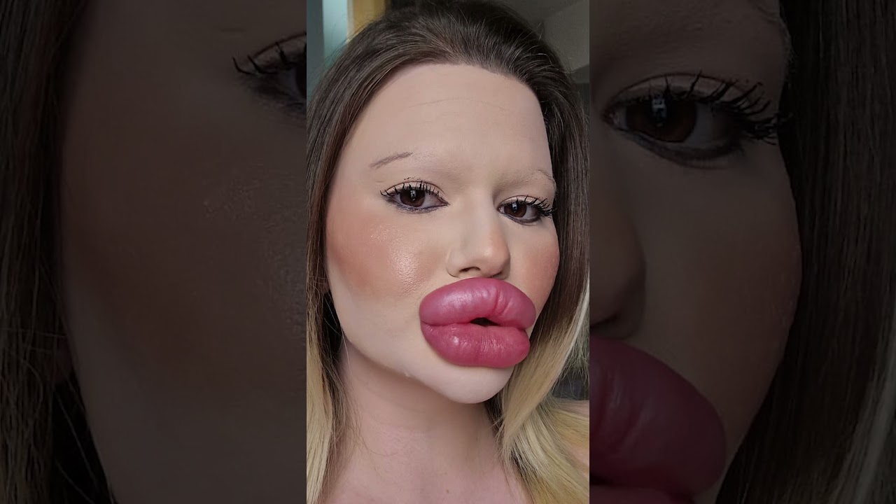 Самые большие губы в мире 
