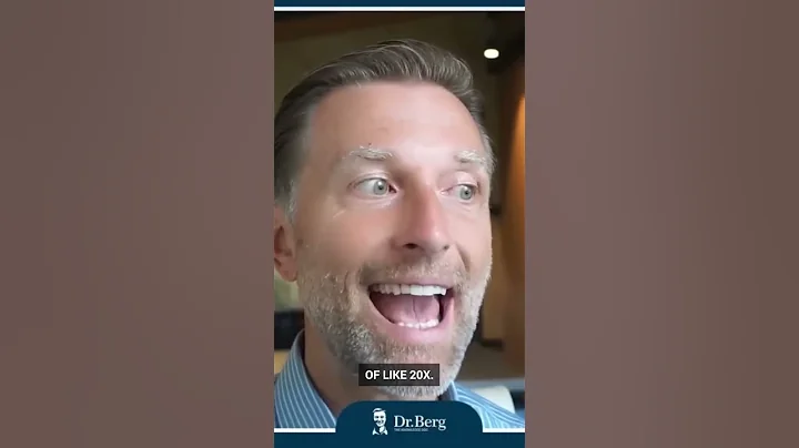 Dr. Berg explains if too much vitamin D can cause arthritic problems or not