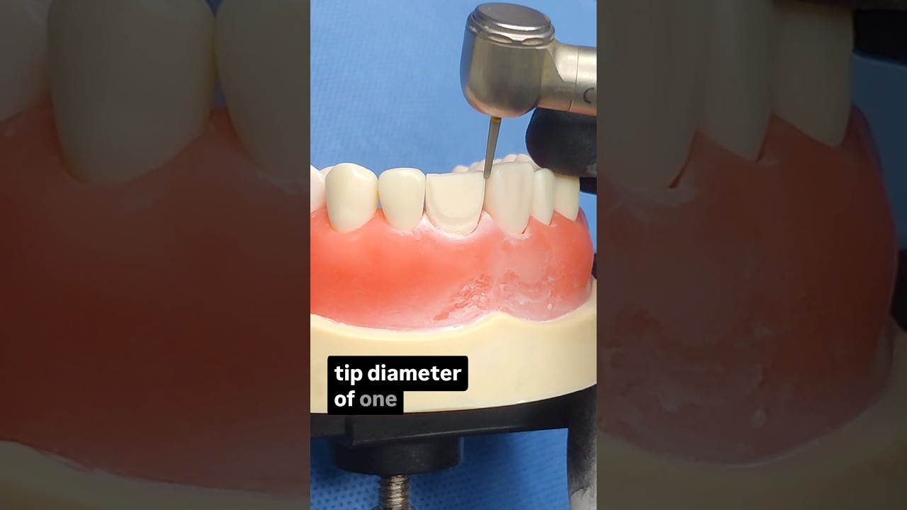 The Veneer Prep Guide - Margins #dentalveneers #porcelainveneers #smiledesign #smilemakeover
