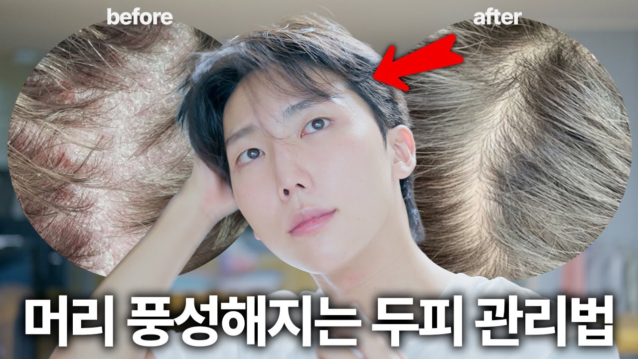 탈모로 1000만원 날리고 깨달은, 머리결·숱 풍성해지는 두피관리 루틴