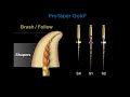 Canal preparation with protaper gold  dentsply sirona