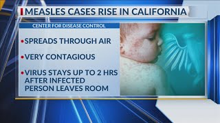 'it Stays In The Air For Two Hours': Doctor Warns Of Measles Cases On The Rise | 17 News At Sunrise