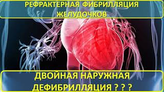 Рефрактерная фибрилляция желудочков и альтернативные режимы дефибрилляции (Двойная наружная и др.)