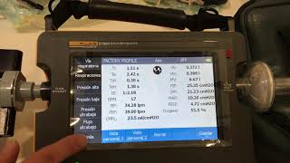 Pruebas en Ventilador OxyMag con VT900