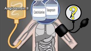 Treating Vasodilatory Shock