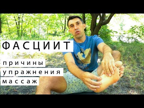 Плантарный фасциит. Личный опыт