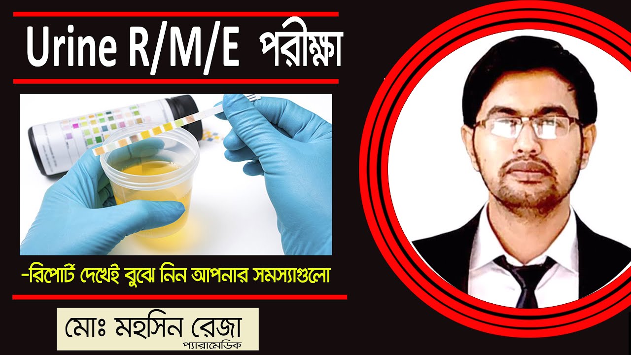 Urine RME Urine RME Test Examination urine-rme-urine-rme-test-examination