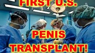 FIRST US PENIS TRANSPLANT
