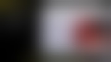 Imaging techniques for safe dissection IOC & other methods of biliary imaging