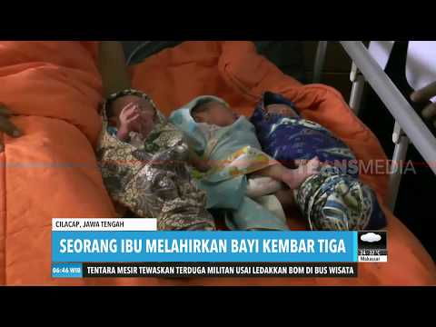 Bayi Kembar 3 Lahir di Cilacap dengan Persalinan Normal
