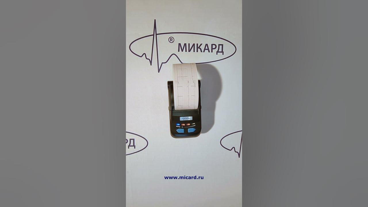 Термопринтер для кардиографа "Кардиометр-МТ" - YouTube