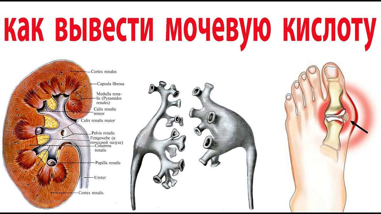 Все Врачи пьют этот чай. Снижает уровень мочевой кислоты и лечит ...