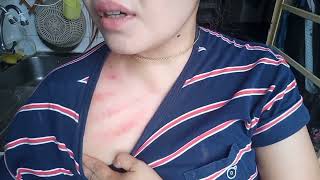 VLOG TKW HONGKONG || Kerokan dada wanita terbaru || Tkw masuk angin kerokan sendiri