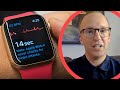 The apple watch actually saved my life: Here's how