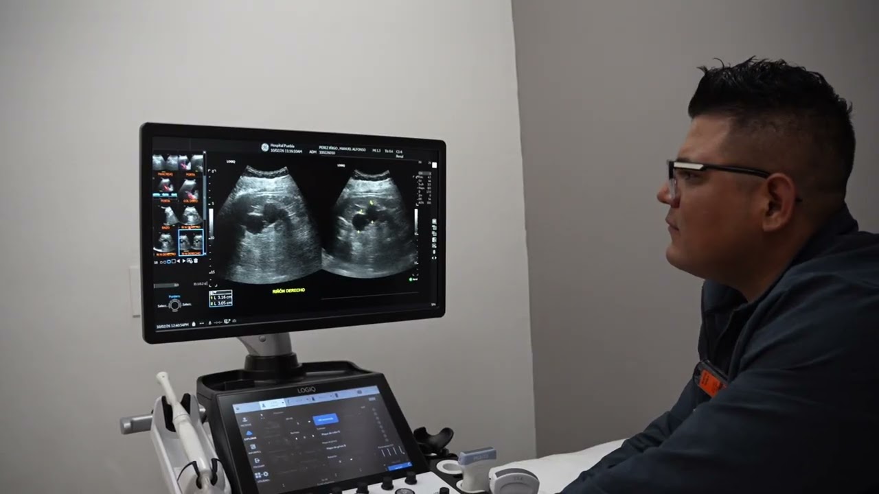 Contamos con tecnología avanzada para Ultrasonografías | Hospital Puebla
