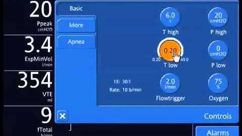 APRV  Assessing Expiratory Flow