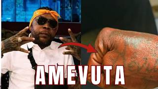 Vybz Kartel Amewashangaza wengi Baada Ya Kufuta Tatoo Yake ya kipepo