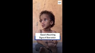 Download Lagu Gaza’s Haunting Signs of Starvation MP3 Download Lagu Gaza’s Haunting Signs of Starvation MP3