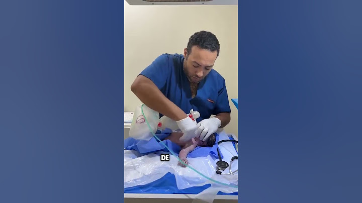 Doctor devuelve a la vida a un bebé nacido sin respirar ❤️