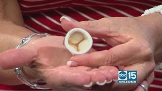 Rally for Red: Mayo Clinic experts talk aortic stenosis