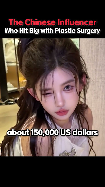 Plastic Surgery💎Made Her a Star:China’s Viral Influencer💖
